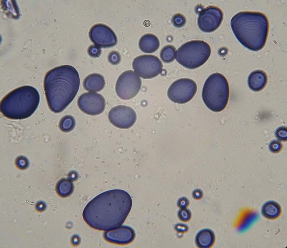 <b>Amyloplastes de pomme de terre colorés à l’eau iodée</b><div><i>©RS.2020</i><b><br></b></div>