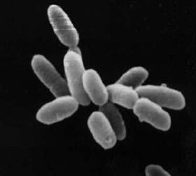 <b>Archée</b><div><i>Halobacteria.jpg, Par NASA, via Wikimédia Commons, domaine public, https://commons.wikimedia.org/wiki/File:Halobacteria.jpg</i><b><br></b></div>