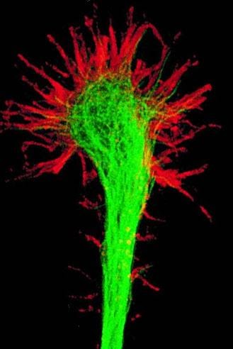 <b>Cône de croissance de l’axone : les filaments d’actine sont colorés en rouge</b><div><i>Growthcone, par via wikimedia commons, domaine publique, https://commons.wikimedia.org/wiki/File:Growthcone.jpg</i><b><br></b></div>