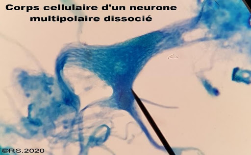 <b>Corps cellulaire d’un neurone multipolaire</b>