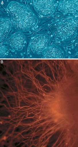 <b>Cellules souches embryonnaires humaines et neurone différencié</b><div><i>319px-Human_embryonic_stem_cells, par Images: Nissim Benvenisty , via Wikimédia Commons, CC-BY-2.5, https://commons.wikimedia.org/wiki/File:Human_embryonic_stem_cells.png</i><b><br></b></div>