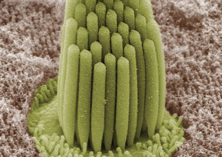 <b>Cellules ciliées observées au microscope électronique et colorisées</b><div><i>By Bechara Kachar via Wikimédia Commons, Domaine public, https://commons.wikimedia.org/wiki/File:Stereocilia_of_frog_inner_ear.01.jpg&nbsp;&nbsp;</i><b><br></b></div>