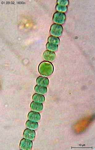 <b>Cyanobactérie observée au microscope optique x 1600</b><div><i>Anabaena sperica2.jpg,  CC-BY-SA-3.0-migré, via Wikimédia Commons, https://commons.wikimedia.org/wiki/File:Anabaena_sperica2.jpg</i><b><br></b></div>