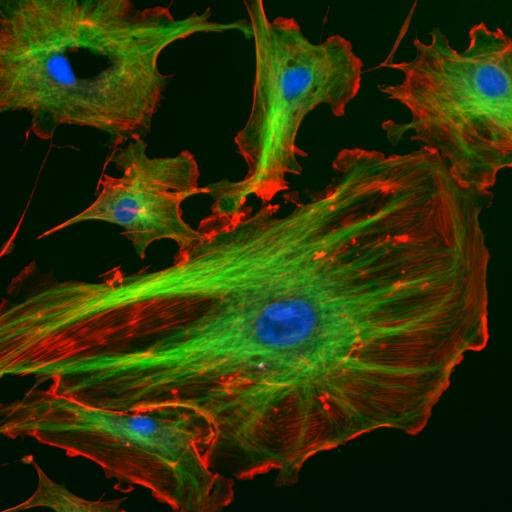 <b>Éléments du cytosquelette d’une cellule pulmonaire bovine</b><div><i>FluorescentCells (1), exemple d'image de ImageJ-Programmpaket (domaine public), https://commons.wikimedia.org/wiki/File:FluorescentCells.jpg</i><b><br></b></div>