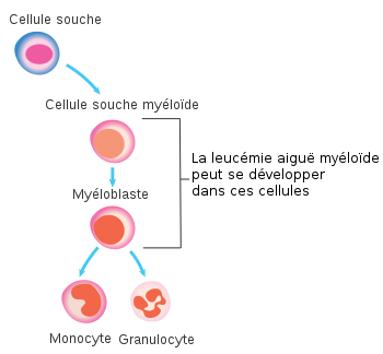 <b>Cellules touchées par l’anomalie génétique responsable de la leucémie myéloïde chronique.</b><div><i>Diagramme montrant les cellules dans lesquelles AML démarre CRUK 297 fr.svg , par Cancer Research UKvia Wikimédia
 Commons, domaine publique,
https://commons.wikimedia.org/wiki/File:Diagram_showing_the_cells_in_which_AML_starts_CRUK_297_fr.svg</i><b><br></b></div>