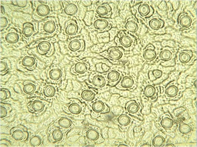 <b>Empreinte d’épiderme inférieur d’une feuille de Laurier,  faite au vernis et vue au microscope optique Gx400</b>