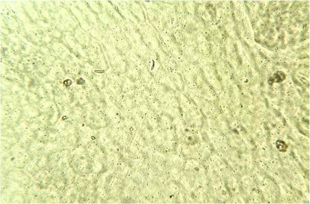 <b>Empreinte d’épiderme supérieur d’une feuille de Laurier,  faite au vernis et vue au microscope optique Gx400</b>