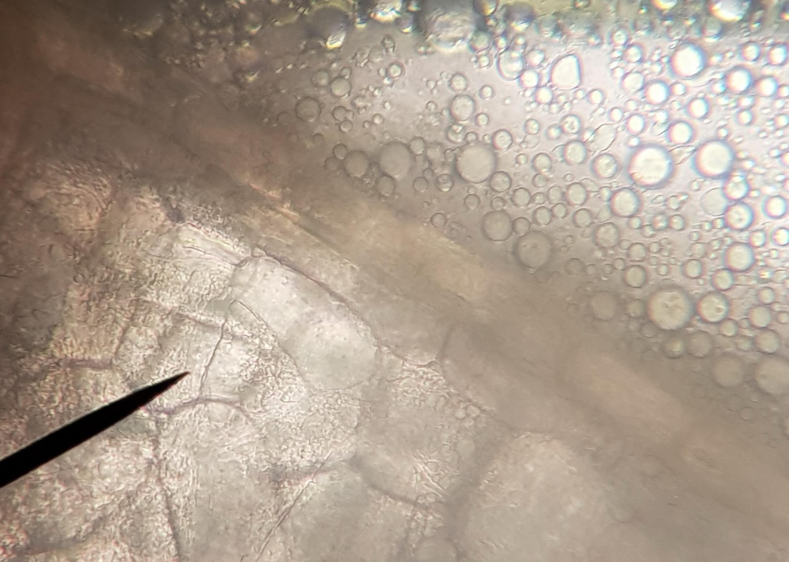 <b>Gouttelettes lipidiques observées au microscope optique x100 après écrasement d’une coupe de cerneau de noix</b><div><i>©RS.2020</i><b><br></b></div>