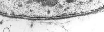 <b>Lame basale observée au microscope électronique à transmission</b><div><i>Basal_lamina, par Robert M. Hunt, propre travail, domaine publique, via wikimedia commons, https://commons.wikimedia.org/wiki/File:Basal_lamina.jpg</i><b><br></b></div>