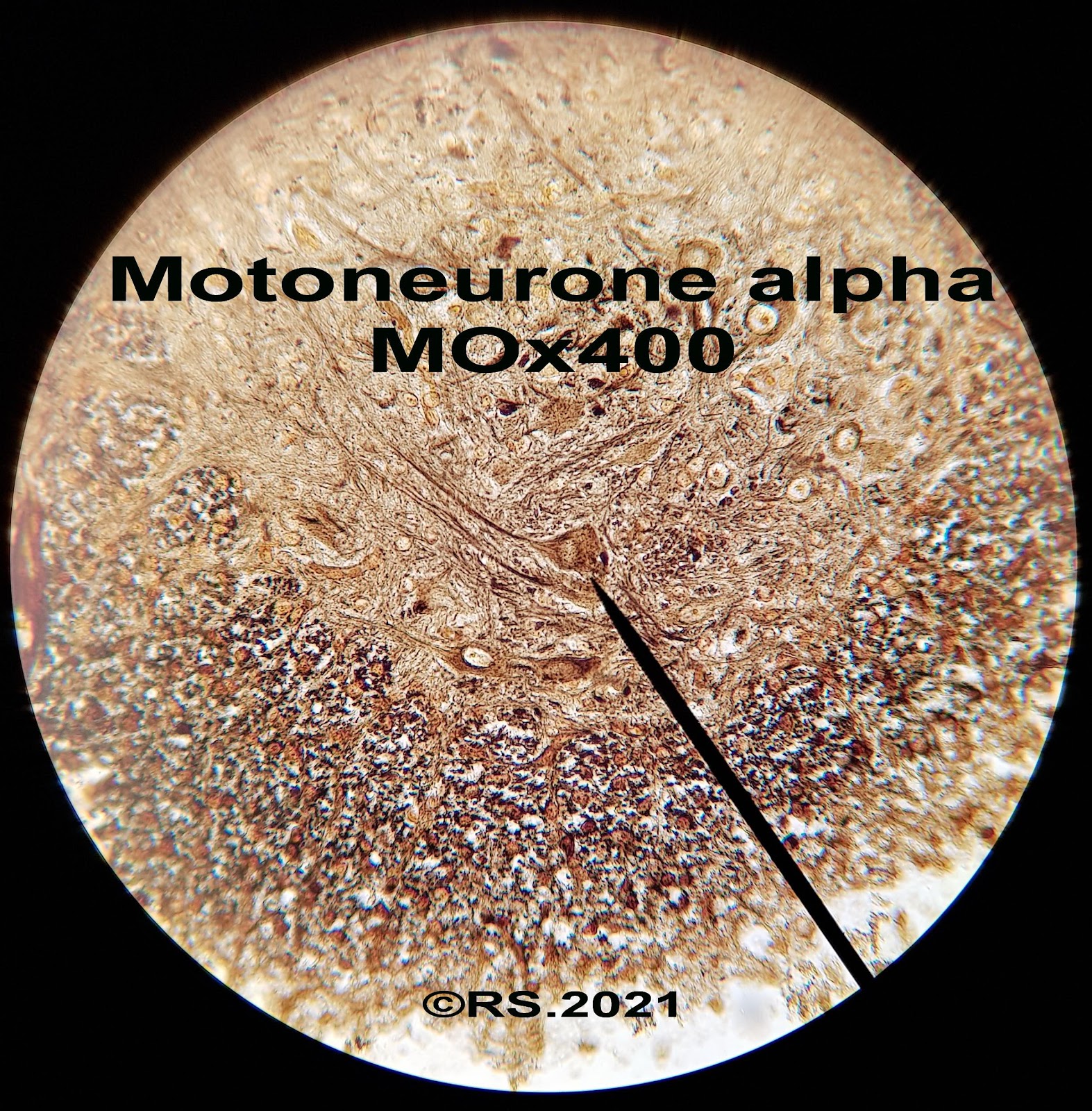 <b>Motoneurone alpha situé dans la partie antérieure de la substance grise de la moelle épinière de chat (à la pointe de l’aiguille)</b>