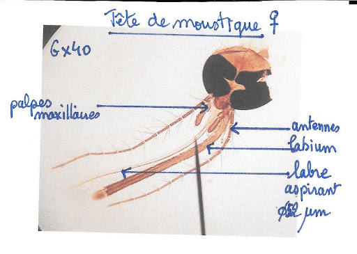 <b>Tête de moustique observée au microscope<br></b><i>©RS.2019</i><br>