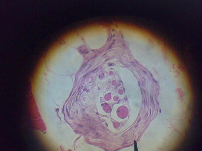 <b>Fuseau neuromusculaire observé au microscope optique montrant au centre les fibres musculaires entourées de fibres nerveuses</b><div><i>800px-Muscle_Spindle_LM_HE_stain, par A. Pedro Marinho via Wikimédia Commons, CC-BY-SA-3.0, https://commons.wikimedia.org/wiki/File:Muscle_Spindle_LM_HE_stain.jpg</i><b><br></b></div>