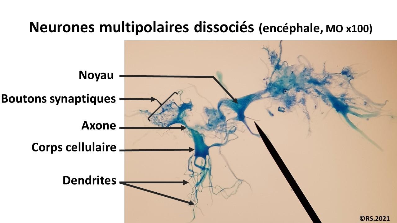 <b>Neurones multipolaires dissociés de cerveau</b>