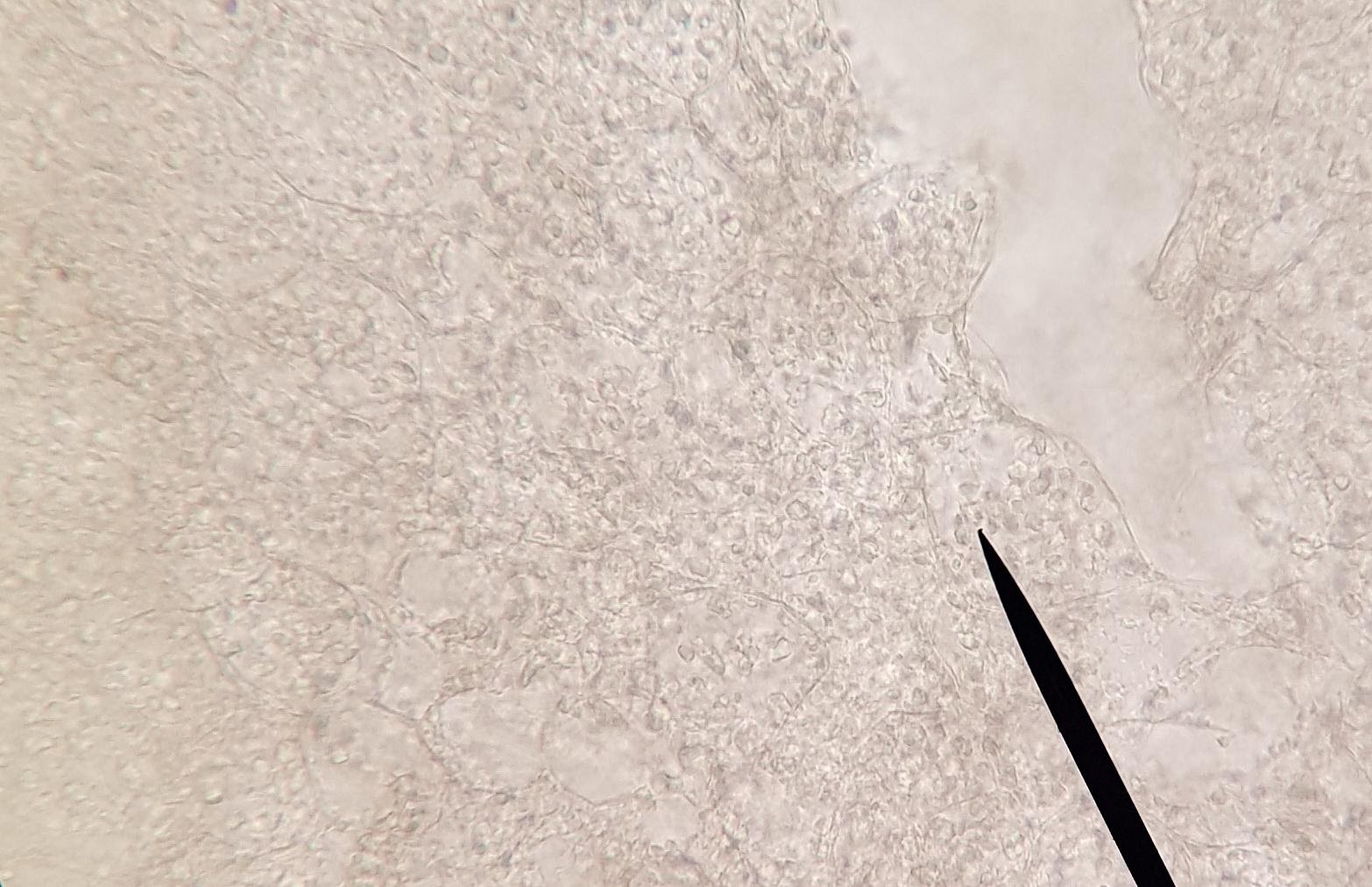 <b>Coupe de cerneau de noix observé au microscope optique x100</b><div><i>©RS.2020</i><b><br></b></div>