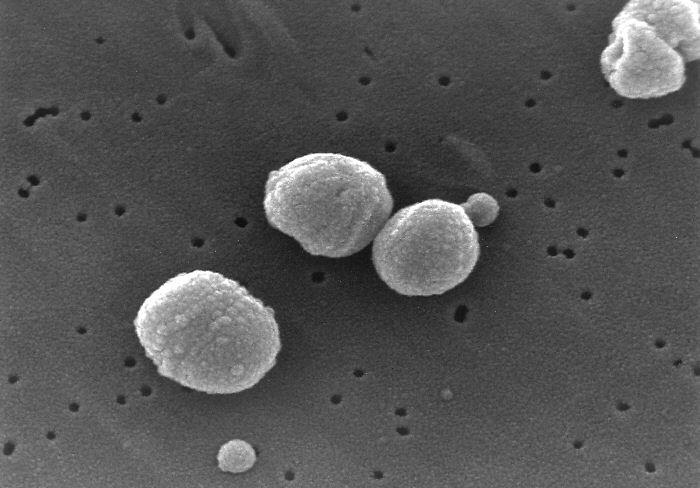 <b>Streptococcus pneumoniae observées au microscope électronique à balayage</b><div><i>Streptococcus pneumoniae.jpg PD-USGov-HHS-CDC, domaine publique, via Wikimédia Commons,  https://commons.wikimedia.org/wiki/File:Streptococcus_pneumoniae.jpg</i><b><br></b></div>
