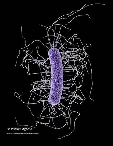<b>Bactérie responsable du tétanos<br></b><i>Clostridium difficile CDC.jpg, via Wikimédia Commons, par CDC / James Archer, CC-BY-SA-4.0 https://commons.wikimedia.org/wiki/File:Clostridium_difficile_CDC.jpg</i>