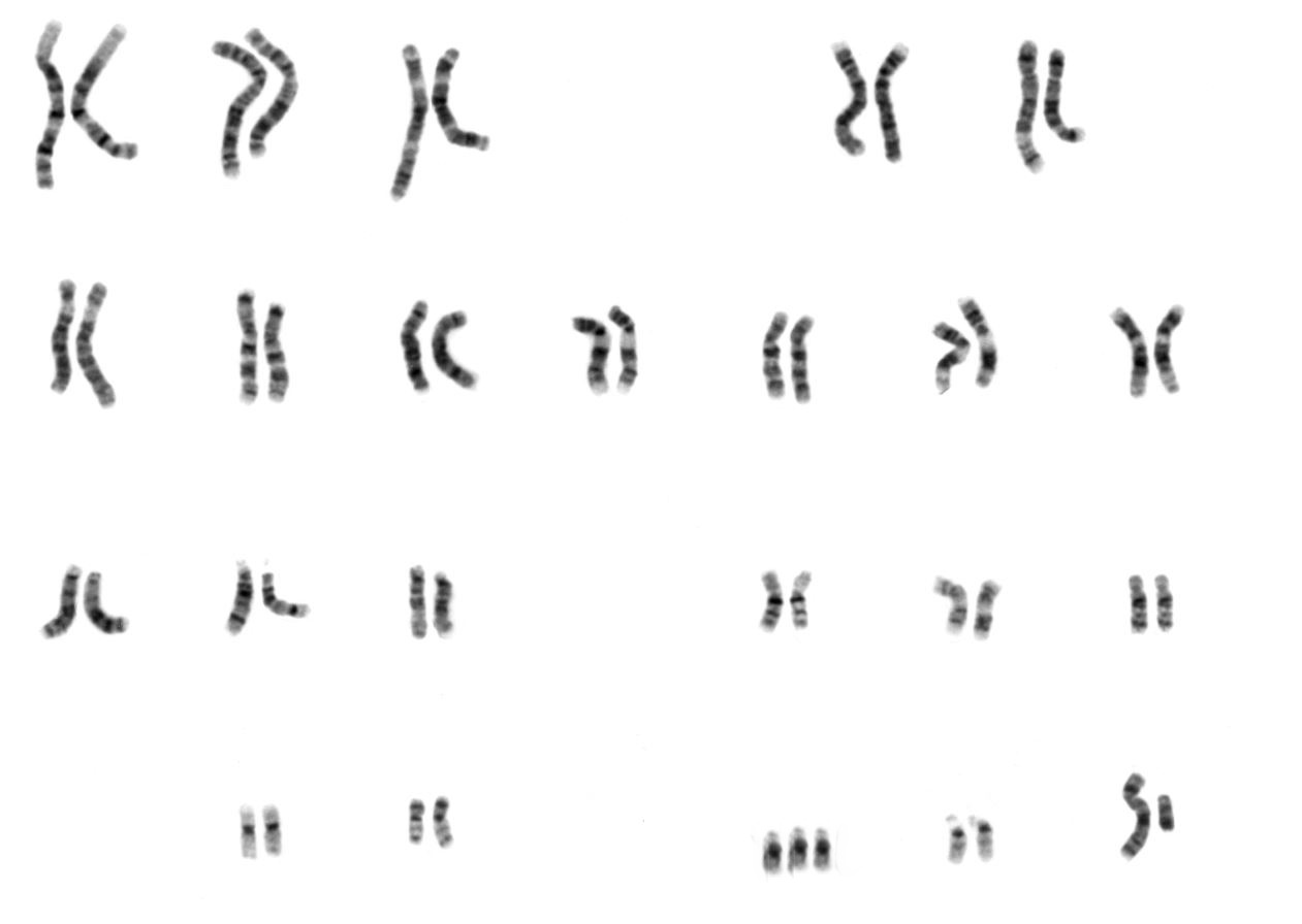 <b>Caryotype montrant une trisomie 21</b><div><i>NHGRI caryotype humain masculin.png, par UCSC human chromosome colours.pngvia Wikimédia Commons, domaine publique,
 modifié par Sandra Rivière https://commons.wikimedia.org/wiki/File:NHGRI_human_male_karyotype.png</i><b><br></b></div>