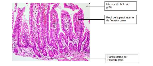 Coupe de l’intestin grêle observée au microscope.

Normal Small Intestine Mucosa par Ed Uthman via Flickr, CC BY 2.0, modifié par Sandra Rivière