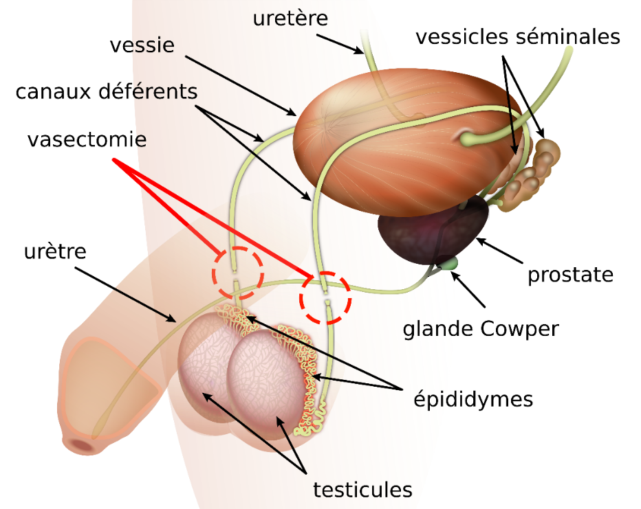 <b>Vasectomie<br></b><i>File:Vasectomie fr.svg parVasectomy diagram-en.svg: KDS444, derivative work (translation): KDS4444, CC-BY-SA-3.0 via Wikimédia commons</i>