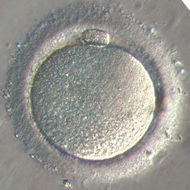 <b>Ovule de femme observé au microscope grossissement x400<br></b><i>Source : Ovocyte II.png par Homme en Noir via wikimédias,  CC-BY-SA-4.0 </i>