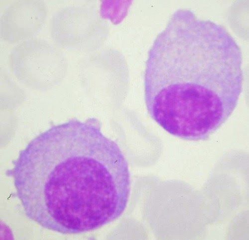 <b>Plasmocytes</b><div><i>source : Plasmocyte-4.jpg par Guy Waterval via wikimédia commons, Apache License, https://commons.wikimedia.org/wiki/File:Plasmocyte-4.jpg?uselang=fr  </i><b><br></b></div>