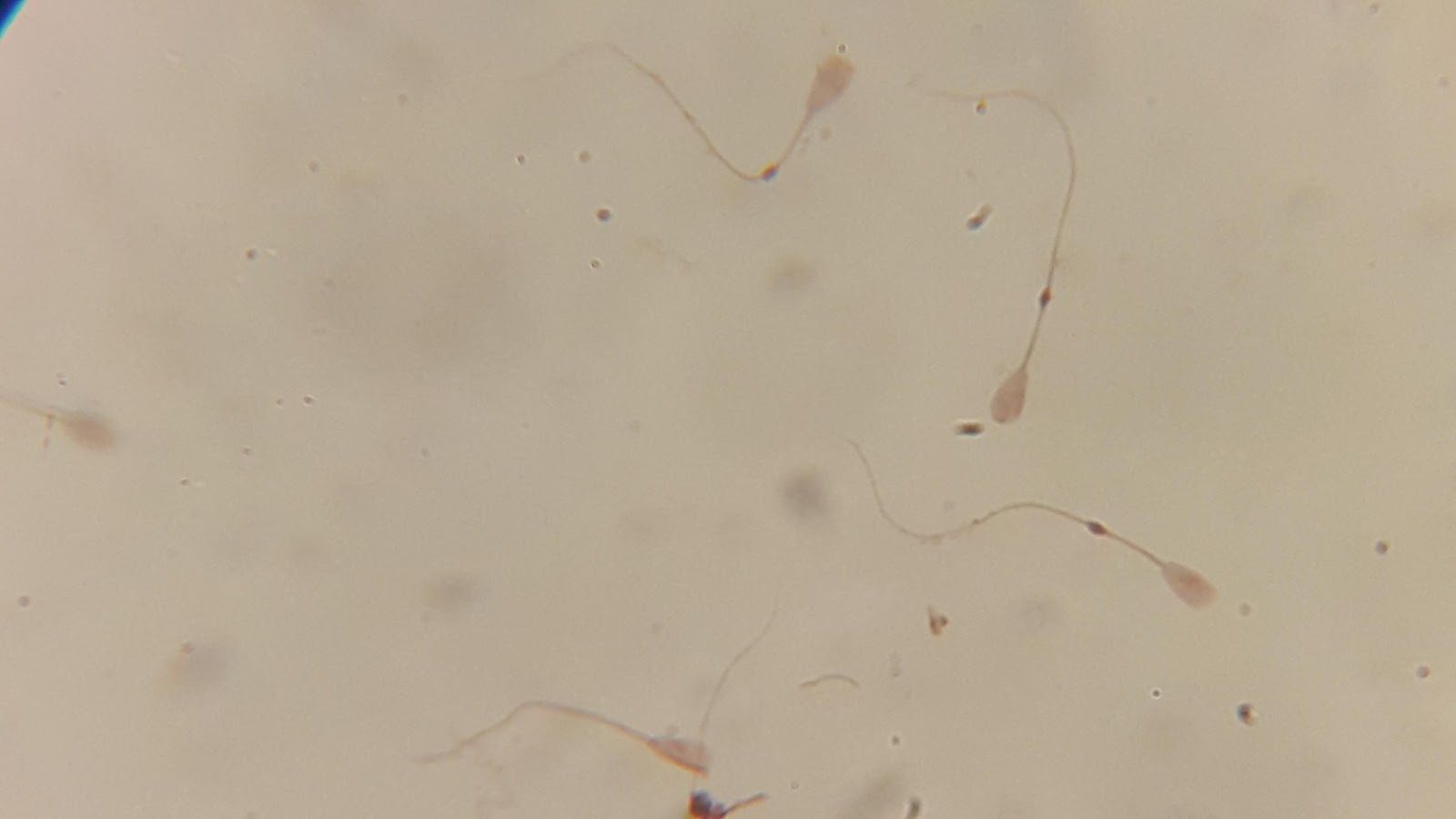 <b>Spermatozoïdes de taureau observés au microscope grossissement x600<br></b><i>©RS.2017</i>