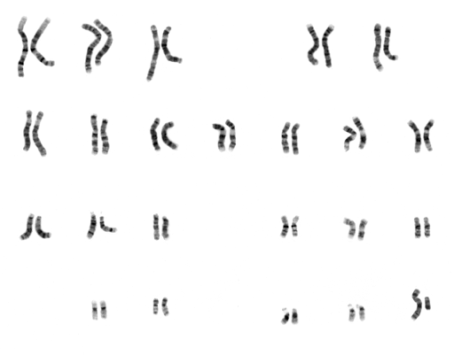 <b>Caryotype d'une femelle en haut (XX) et d'un mâle en bas (XY).<br></b><i>Mapa genético o cariograma.jpeg CC-BY-SA-3.0-migrated Via Wikimedia commons, https://commons.wikimedia.org/wiki/File:Mapa_gen%C3%A9tico_o_cariograma.jpeg NHGRI human male karyotype.png Par Courtesy: National Human Genome Research Institute, via Wikimedia commons, Domaine public, https://commons.wikimedia.org/wiki/File:NHGRI_human_male_karyotype.png?uselang=fr</i>