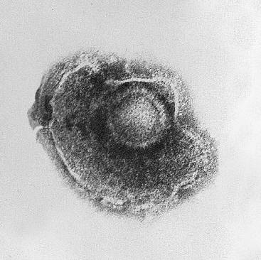 <b>Virus de la varicelle</b><div><i>Virus de la varicelle : Varicella (Chickenpox) Virus PHIL 1878 lores.jpg, par CDC USA, Domaine public, via Wikimédia Commons, https://es.m.wikipedia.org/wiki/Archivo:Varicella_(Chickenpox)_Virus_PHIL_1878_lores.jpg</i><b><br></b></div>